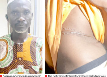 Government Vows Stricter Measures Against Illegal Kidney Harvesting