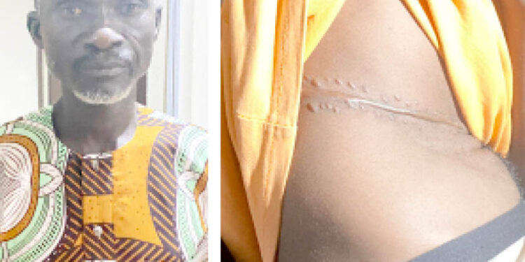 Government Vows Stricter Measures Against Illegal Kidney Harvesting