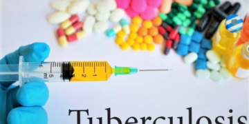 Plateau Records 5,397 Tuberculosis Cases in 2025 as Health Authorities Intensify Response