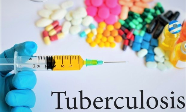 Plateau Records 5,397 Tuberculosis Cases in 2025 as Health Authorities Intensify Response