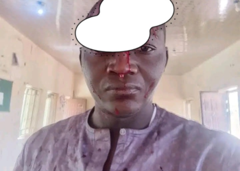 Bauchi Radio Station Demands Suspension of DPO Over Alleged Assault on Reporter