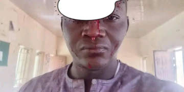 Bauchi Radio Station Demands Suspension of DPO Over Alleged Assault on Reporter