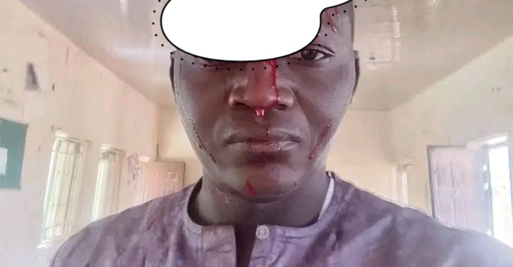 Bauchi Radio Station Demands Suspension of DPO Over Alleged Assault on Reporter