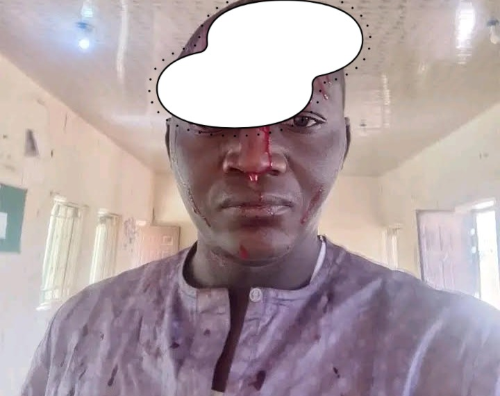 Bauchi Radio Station Demands Suspension of DPO Over Alleged Assault on Reporter