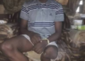 17-Year-Old Daniel Akanni Seeks ₦2m for Leg Amputation, Prosthetic Limb