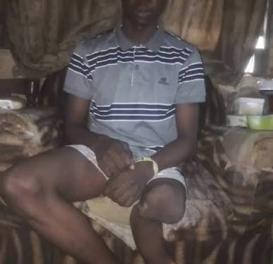 17-Year-Old Daniel Akanni Seeks ₦2m for Leg Amputation, Prosthetic Limb